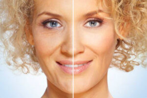 Эффект пластыря для разглаживания морщин