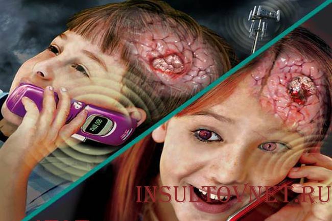 Влияние сотового телефона на мозг