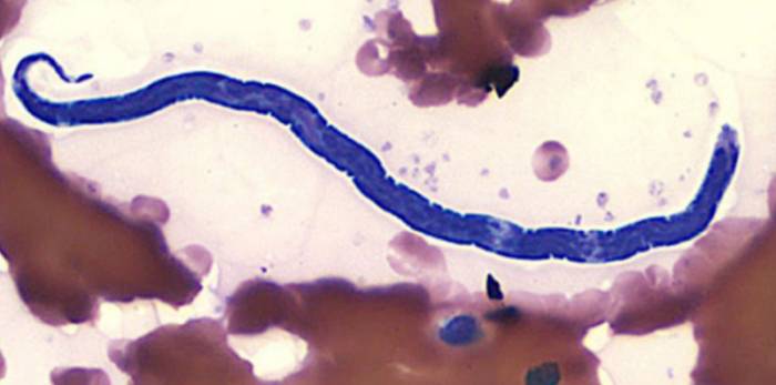 глистные инвазии