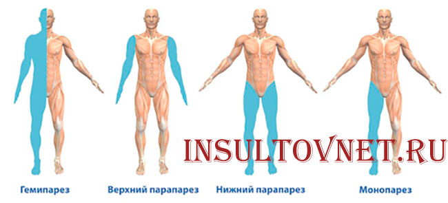 нарушения движений