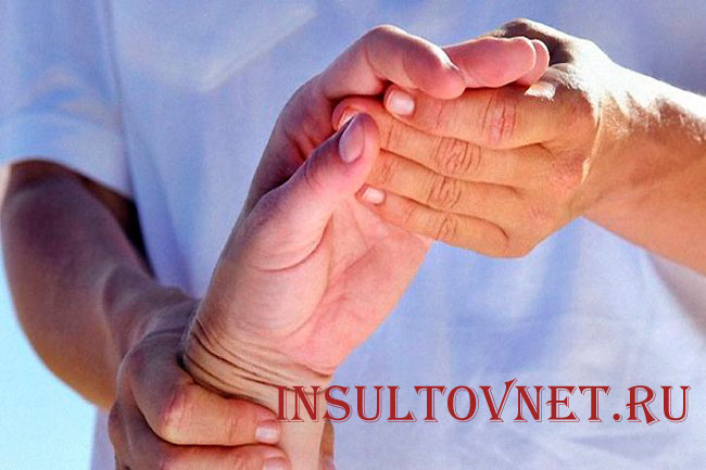 Онемение рук