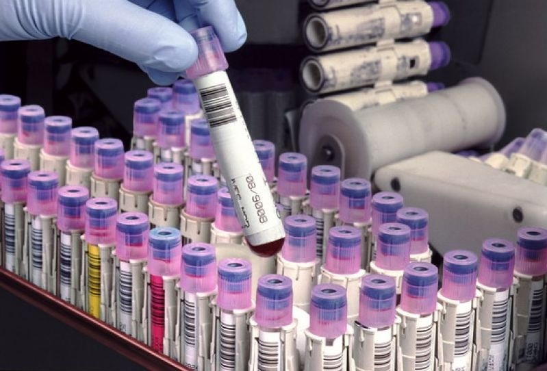 ПЦР диагностика