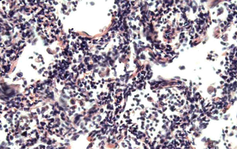 хламидиоз респираторный