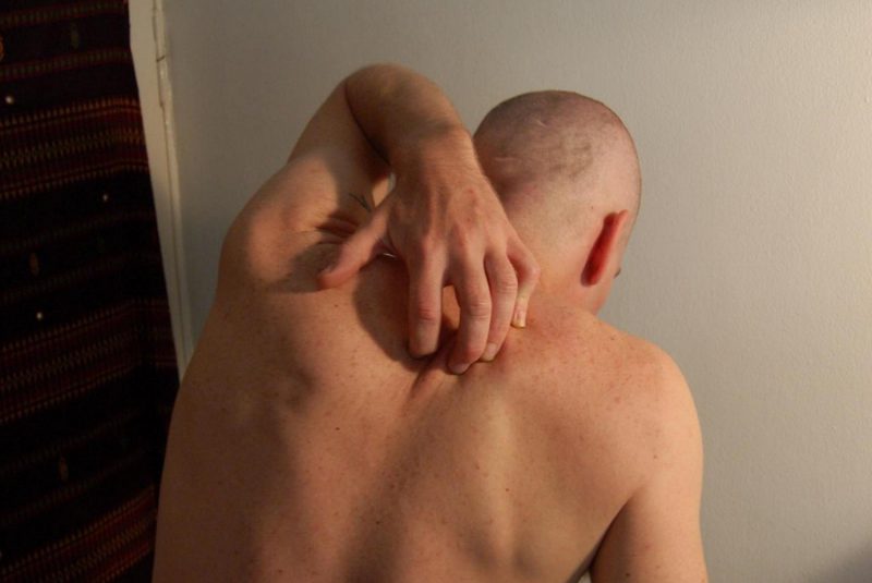 Чесотка инкогнито