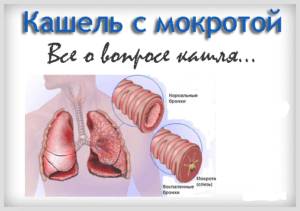 Кашель с мокротой у ребенка