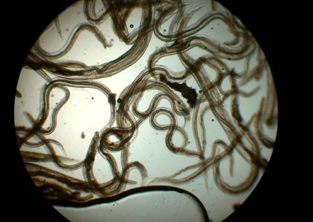 паразиты в организме