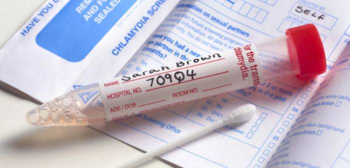 результаты анализов