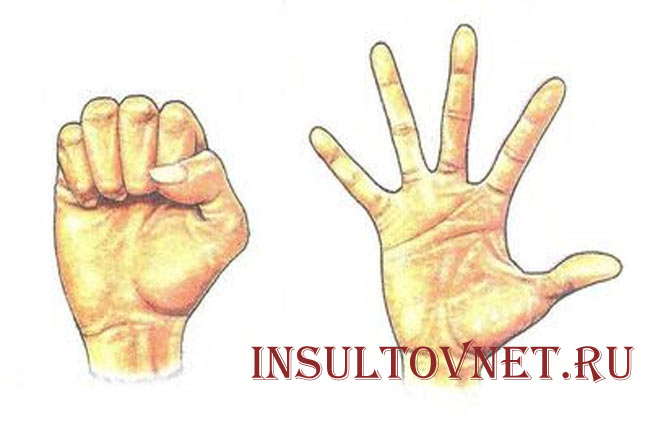 Сжатие руки в кулак