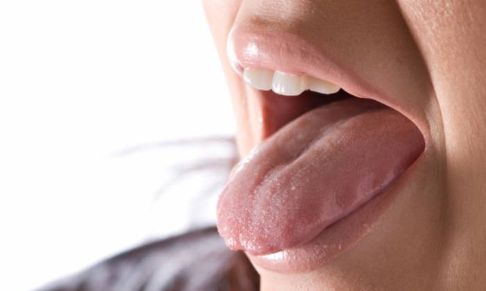 сухость во рту