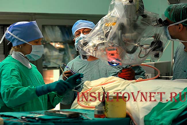 Операция при инсульте