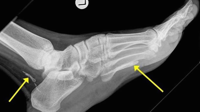 Профилактика