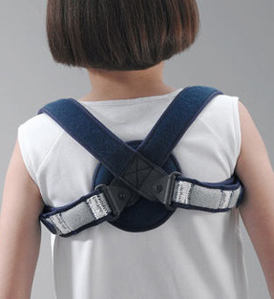 Кольца Дельбе Перелом ключицы часто происходит по причине сильного давления на грудную клетку или падения на руку