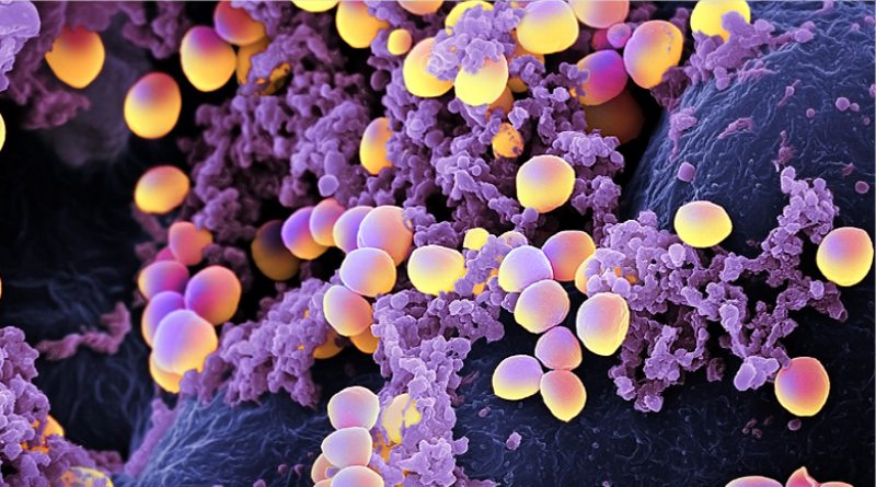 Staphylococcus aureus