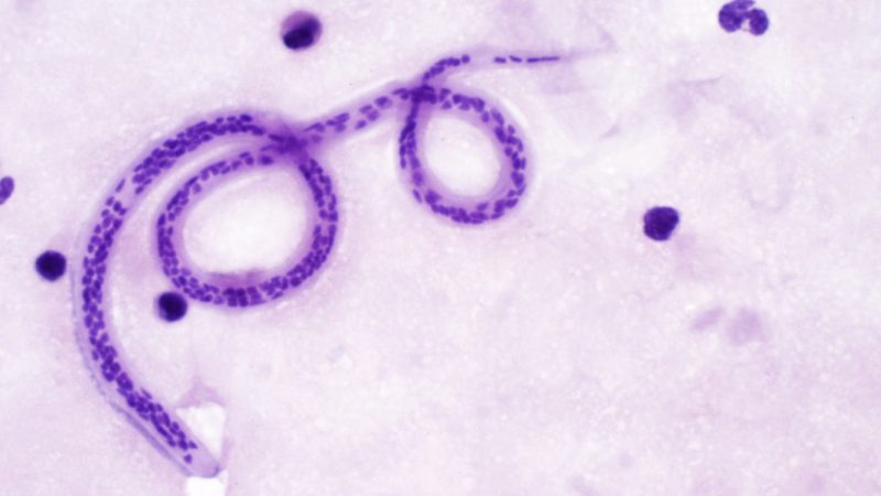 Бругоз Бругоз под микроскопом