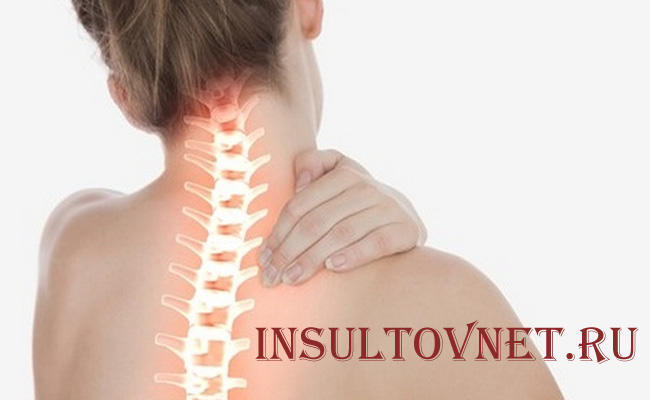 Болит шейный отдел