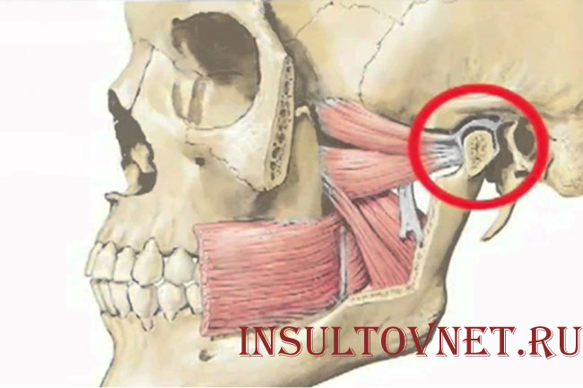 Поражение челюстного сустава