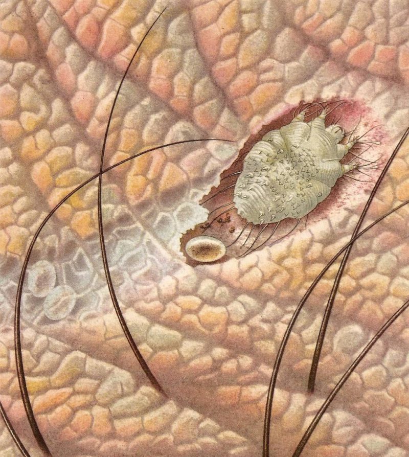 чесоточный зудень