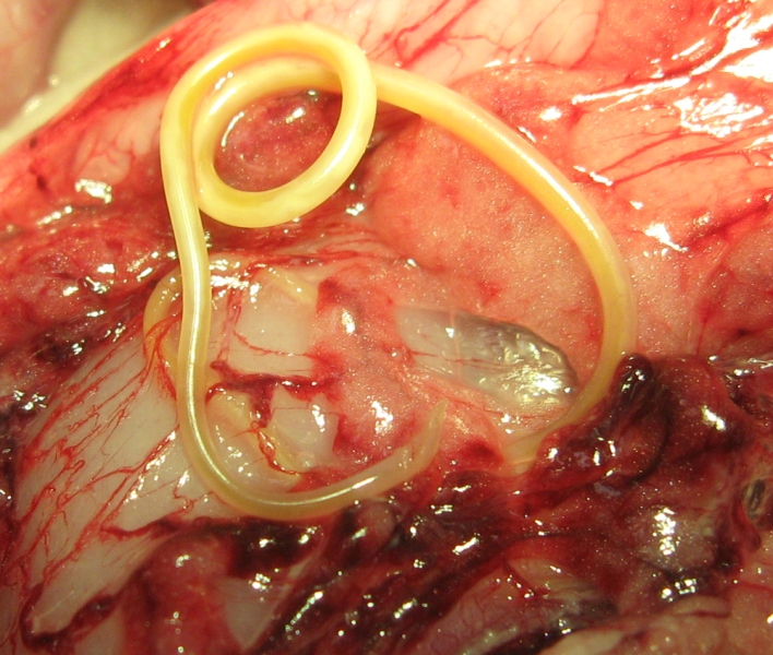 токсокароз