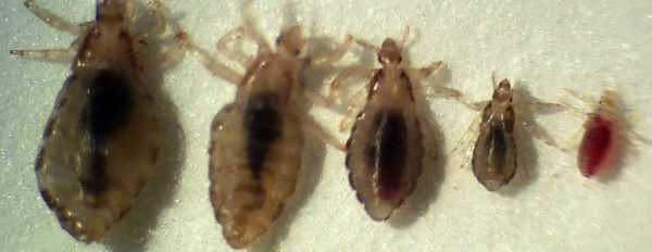 фото вшей разных размеров