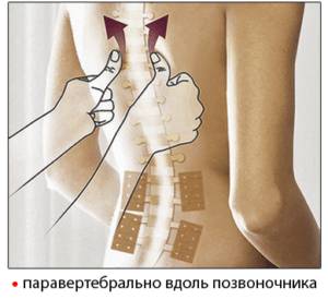 Применение Чжуангу Гао пластыря противоотечного