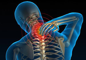Боль в шейном отделе Остеопороз шейного отдела позвоночника