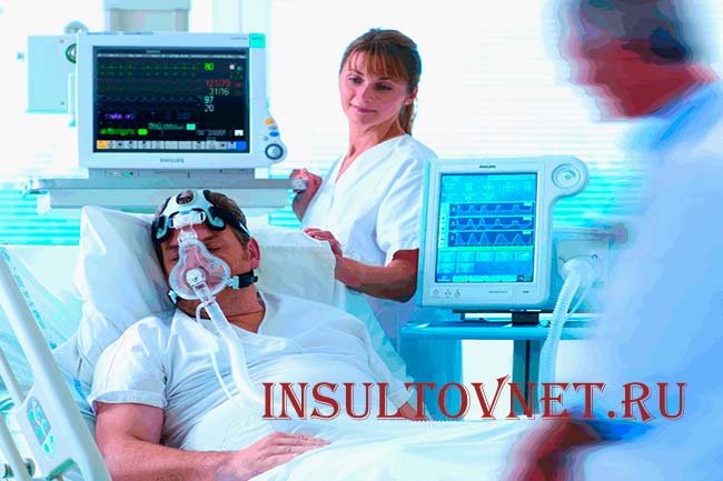 Поддержание жизнедеятельности после инсульта