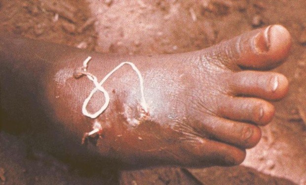 Характеристика червя ришта