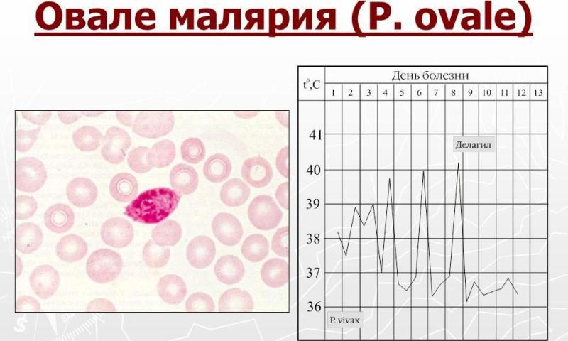 Малярия Овале