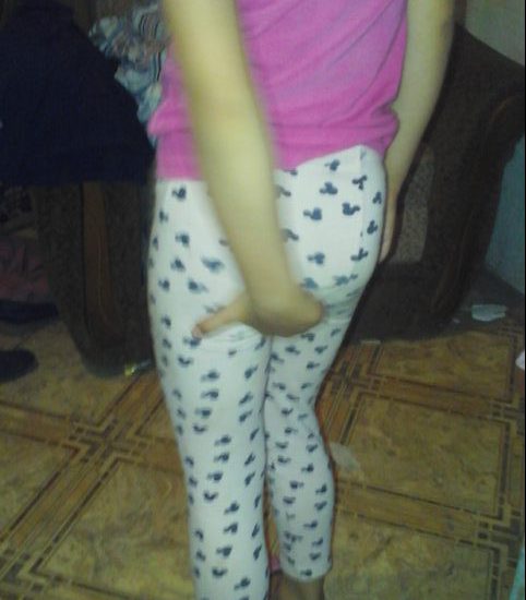 зуд в заднем проходе