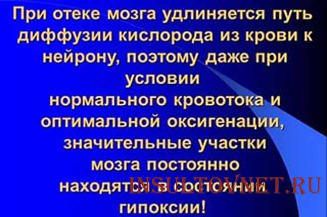 Отек мозговой ткани