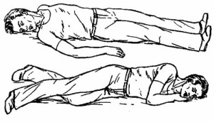 Первая помощь потерпевшему Потерпевшего необходимо уложить навзничь