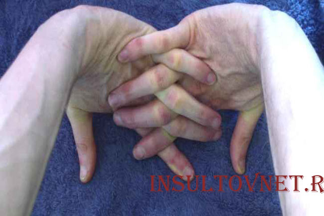 Разминка пальцев