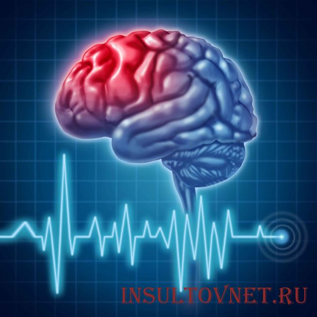 Причины поражения головного мозга