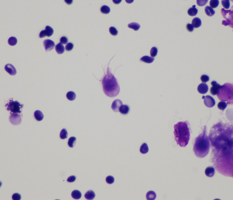 Как выглядят лямблии человека