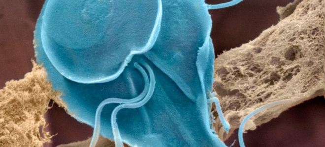 Способы передачи лямблий