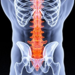 Лечение болезни педжета Болезнь Педжета обнаруживают случайно на рентгенограмма