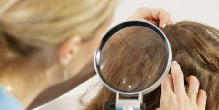 Вши и гниды у ребенка