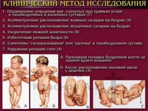Исследования и определение дисплазии по симптомам Клинические методы исследования дисплазии