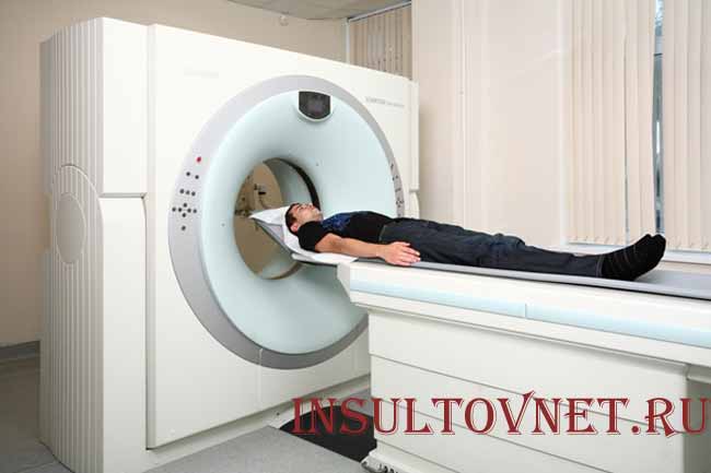 Компьютерная томография головного мозга