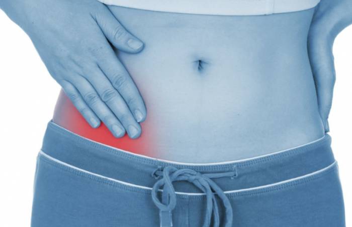 аппендицит