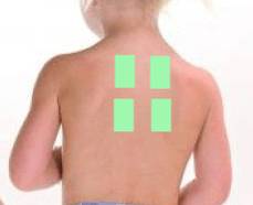 Куда клеить перцовый пластырь при простуде детям