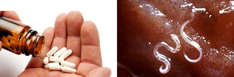 лечение гельминтов
