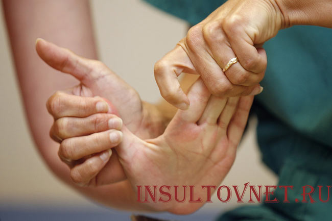 Сгибание кисти после инсульта