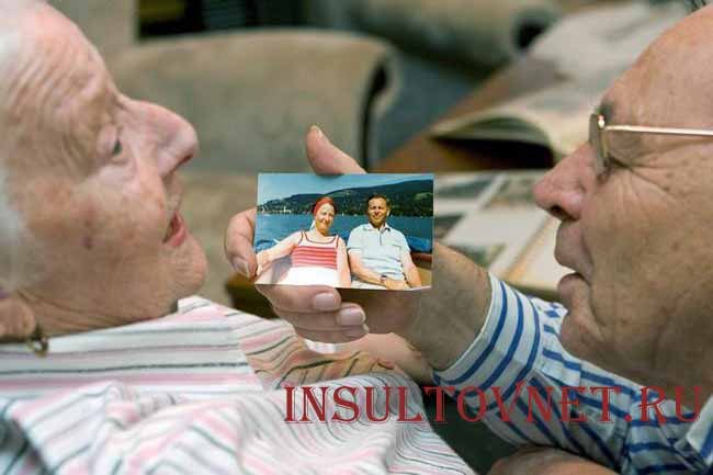 Болезнь Альцгеймера