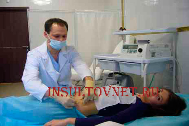 Озоновая терапия и инсульт