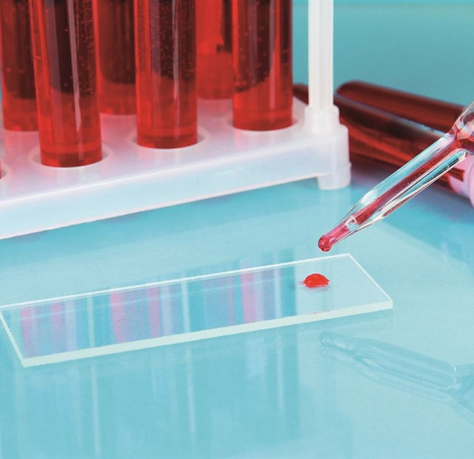 Общий анализ крови на определение печеночного сосальщика