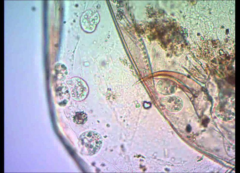 Инфузории поедают дафнию