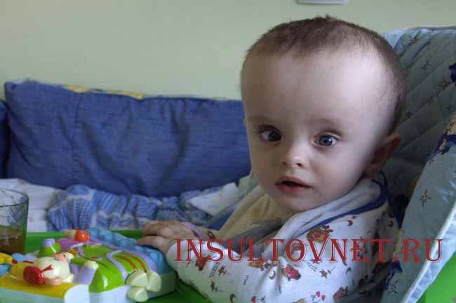 Последствия энцефалопатии