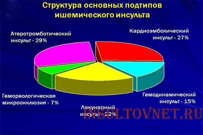 Виды ишемических инсультов