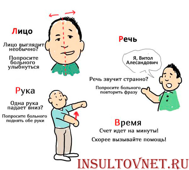 симптомы инсульта